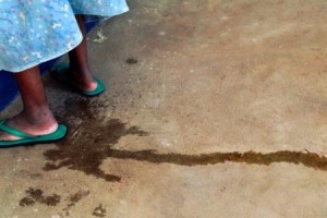 Puddle. Addis Ababa Fistula Hospital